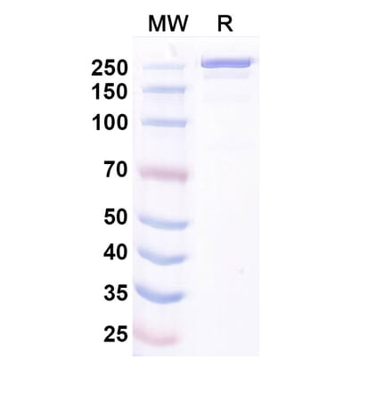 SDS-PAGE - Ocankitug Biosimilar - Anti-TSLP Antibody - BSA and Azide free (A340709) - Antibodies.com