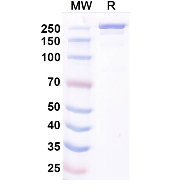 SDS-PAGE - Ocankitug Biosimilar - Anti-TSLP Antibody - BSA and Azide free (A340709) - Antibodies.com