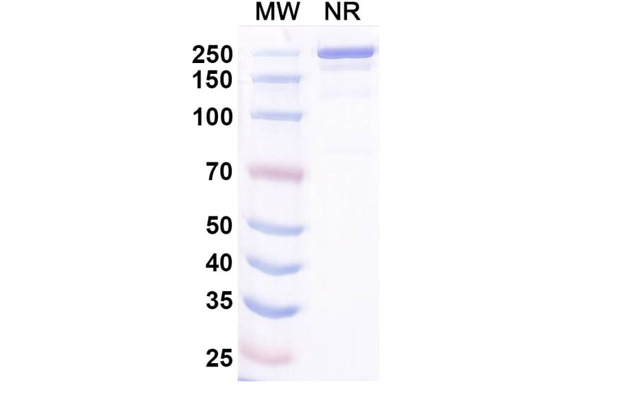 SDS-PAGE - Ocankitug Biosimilar - Anti-TSLP Antibody - BSA and Azide free (A340709) - Antibodies.com