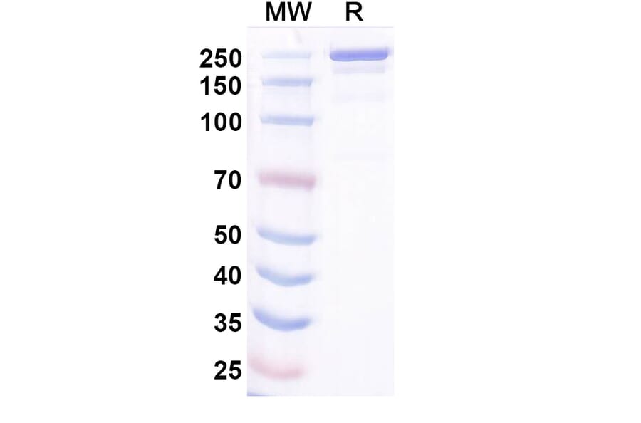 SDS-PAGE - Ocankitug Biosimilar - Anti-TSLP Antibody - BSA and Azide free (A340709) - Antibodies.com