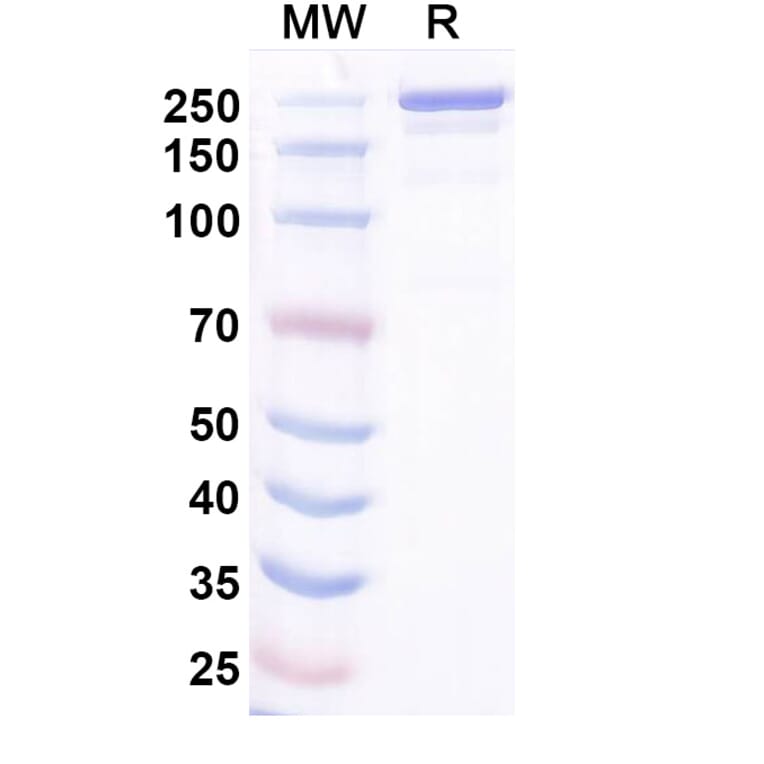 SDS-PAGE - Ocankitug Biosimilar - Anti-TSLP Antibody - BSA and Azide free (A340709) - Antibodies.com