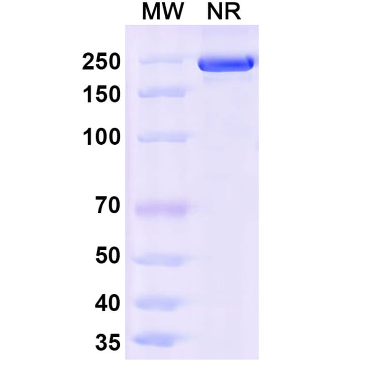 SDS-PAGE - Ocankitug Biosimilar - Anti-TSLP Antibody - BSA and Azide free (A340709) - Antibodies.com