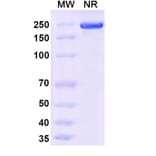 SDS-PAGE - Ocankitug Biosimilar - Anti-TSLP Antibody - BSA and Azide free (A340709) - Antibodies.com