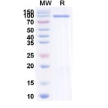 SDS-PAGE - Brivekimig Biosimilar - Anti-OX40L + TNF alpha + Albumin Antibody - BSA and Azide free (A340710) - Antibodies.com