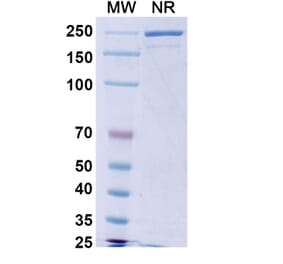 SDS-PAGE - Calotatug Biosimilar - Anti-ErbB2 Antibody - BSA and Azide free (A340711) - Antibodies.com