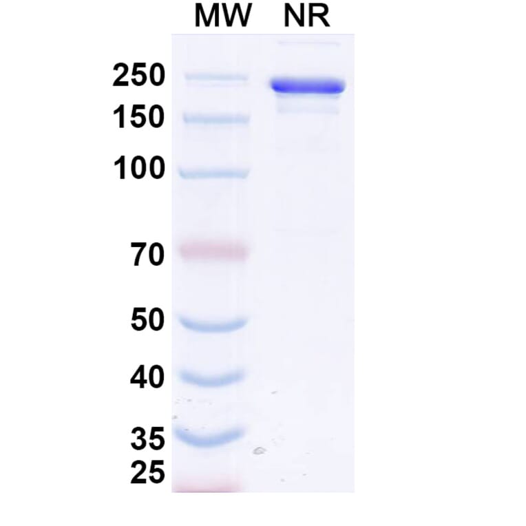 SDS-PAGE - Calotatug Biosimilar - Anti-ErbB2 Antibody - BSA and Azide free (A340711) - Antibodies.com