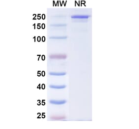 SDS-PAGE - Comekibart Biosimilar - Anti-IL-4R Antibody - BSA and Azide free (A340712) - Antibodies.com