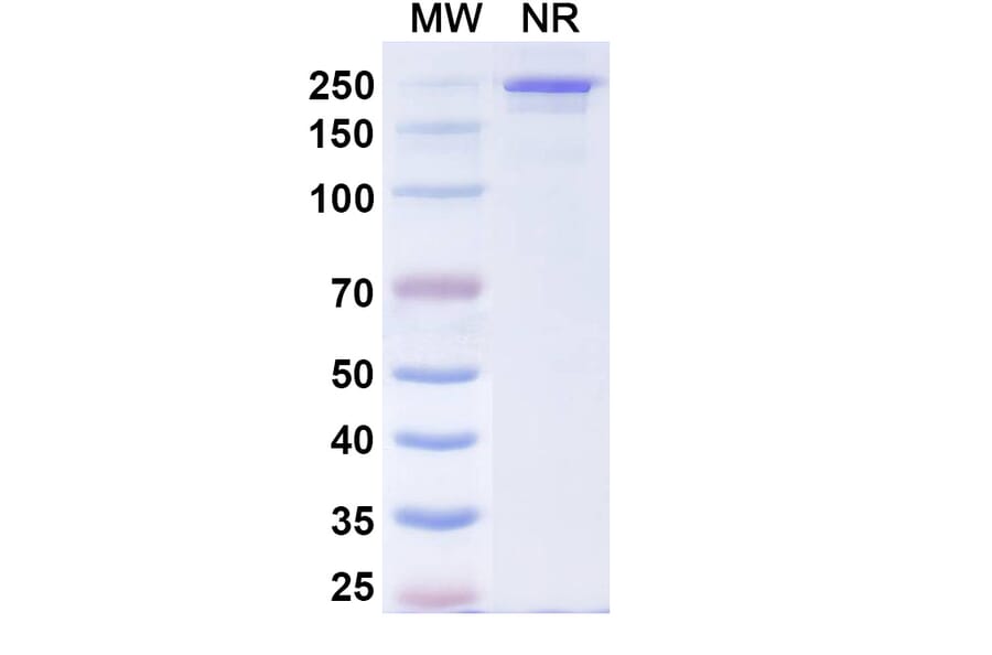 SDS-PAGE - Comekibart Biosimilar - Anti-IL-4R Antibody - BSA and Azide free (A340712) - Antibodies.com