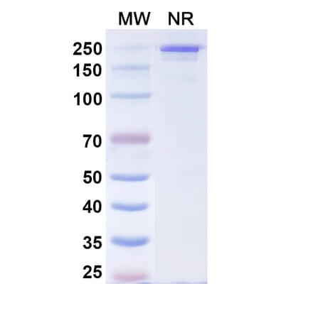 SDS-PAGE - Comekibart Biosimilar - Anti-IL-4R Antibody - BSA and Azide free (A340712) - Antibodies.com