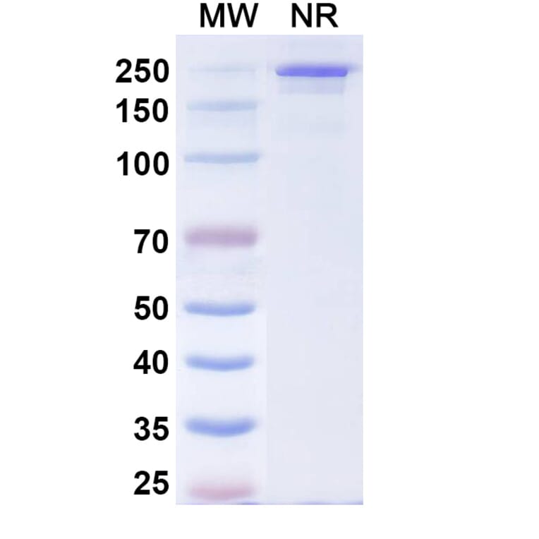 SDS-PAGE - Comekibart Biosimilar - Anti-IL-4R Antibody - BSA and Azide free (A340712) - Antibodies.com