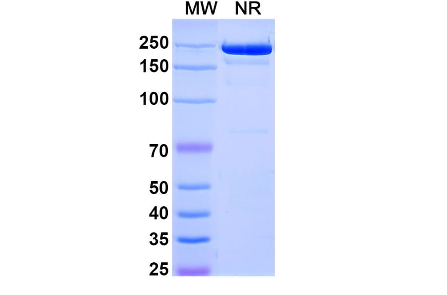 SDS-PAGE - Comekibart Biosimilar - Anti-IL-4R Antibody - BSA and Azide free (A340712) - Antibodies.com