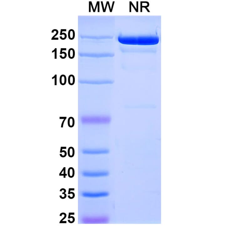 SDS-PAGE - Comekibart Biosimilar - Anti-IL-4R Antibody - BSA and Azide free (A340712) - Antibodies.com