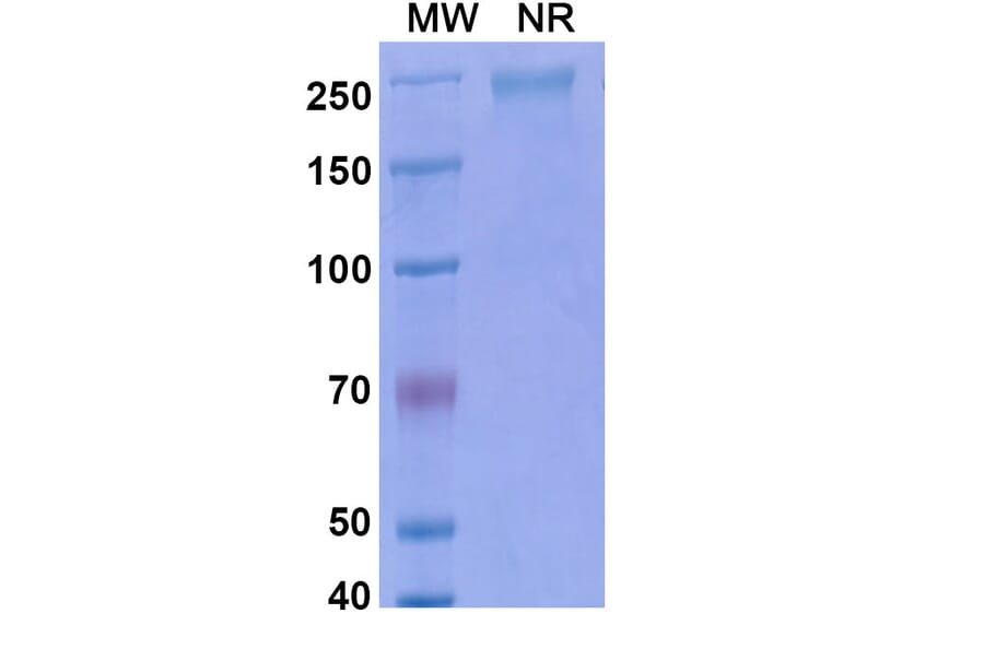 SDS-PAGE - Ebrasodebart Biosimilar - Anti-TMEM219 Antibody - BSA and Azide free (A340718) - Antibodies.com