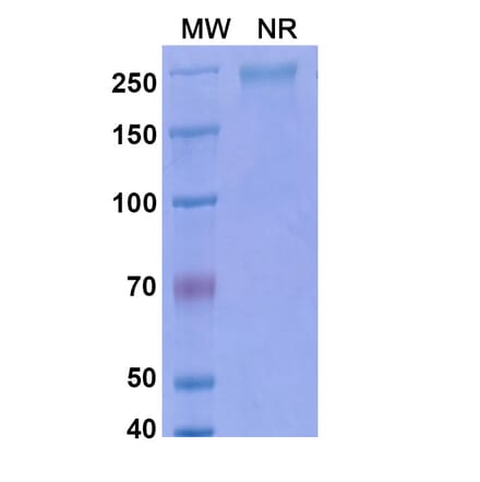 SDS-PAGE - Ebrasodebart Biosimilar - Anti-TMEM219 Antibody - BSA and Azide free (A340718) - Antibodies.com