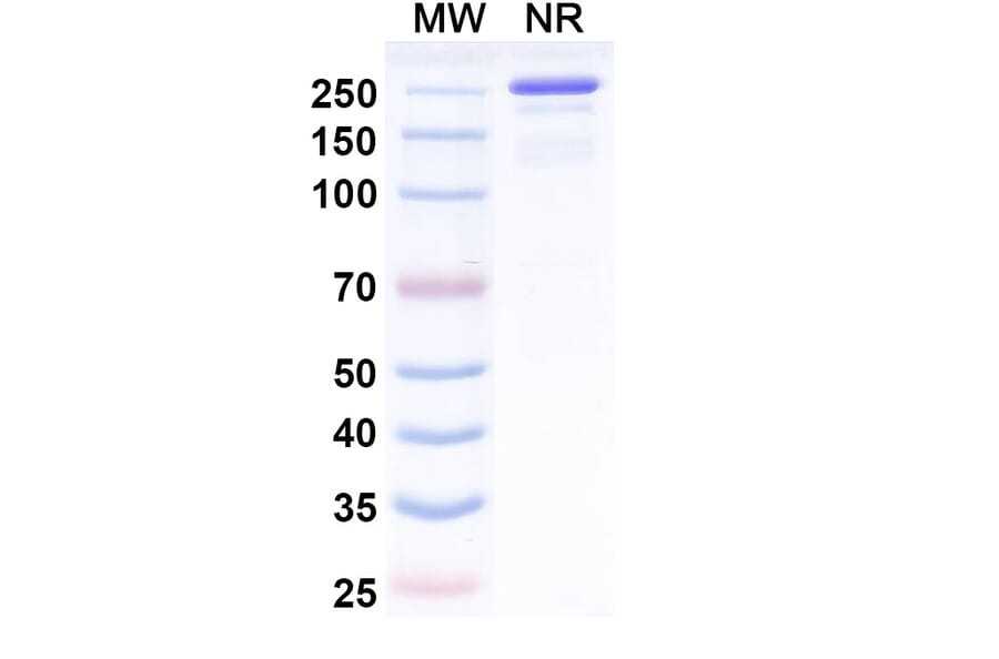 SDS-PAGE - Ebrasodebart Biosimilar - Anti-TMEM219 Antibody - BSA and Azide free (A340718) - Antibodies.com