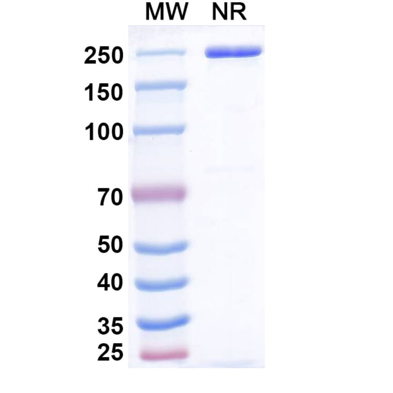 SDS-PAGE - Emiltatug Biosimilar - Anti-B7-H4 Antibody - BSA and Azide free (A340719) - Antibodies.com