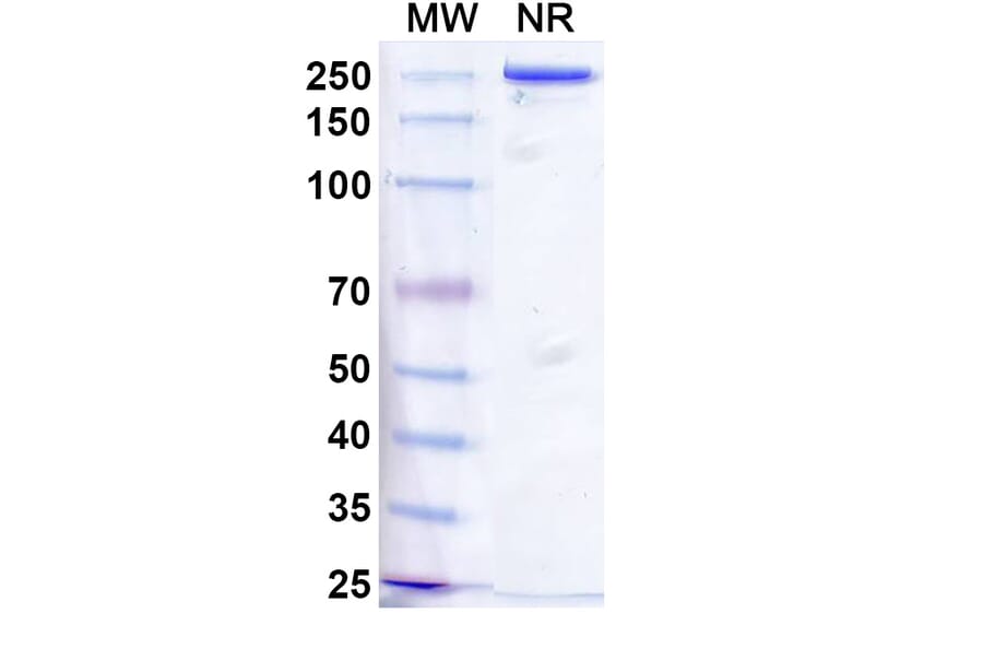 SDS-PAGE - Vixticibart Biosimilar - Anti-NPR1 Antibody - BSA and Azide free (A340724) - Antibodies.com