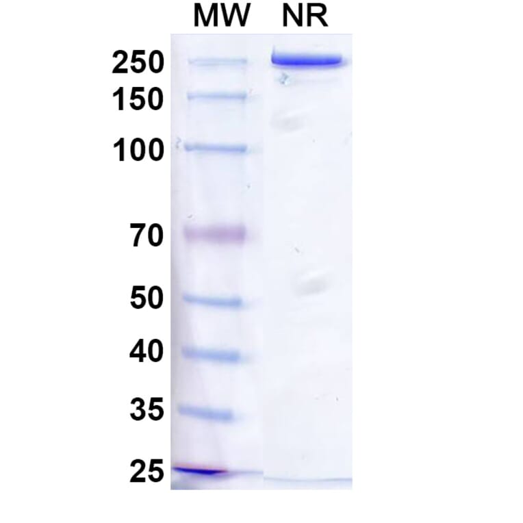 SDS-PAGE - Vixticibart Biosimilar - Anti-NPR1 Antibody - BSA and Azide free (A340724) - Antibodies.com