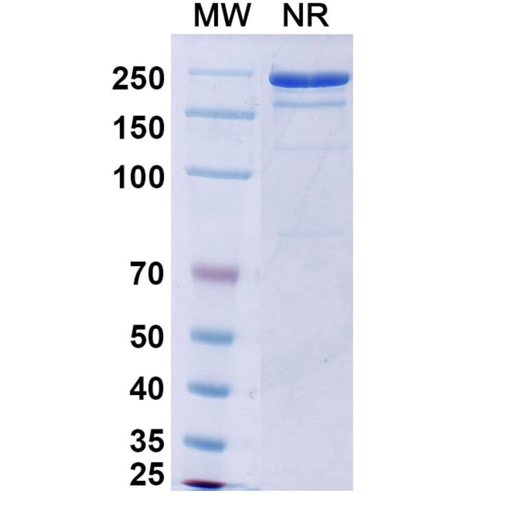 SDS-PAGE - Vixticibart Biosimilar - Anti-NPR1 Antibody - BSA and Azide free (A340724) - Antibodies.com