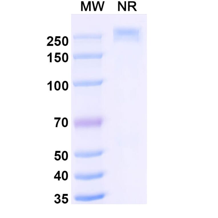 SDS-PAGE - Libevitug Biosimilar - Anti-HBsAg Antibody - BSA and Azide free (A340726) - Antibodies.com