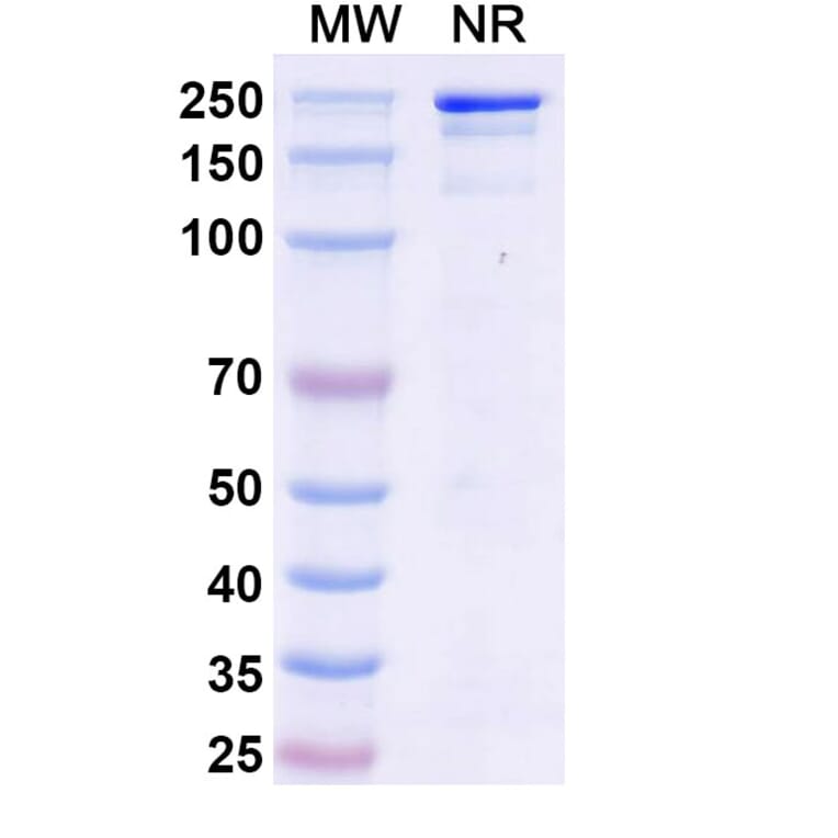 SDS-PAGE - Micvotabart Biosimilar - Anti-Fibronectin Antibody - BSA and Azide free (A340729) - Antibodies.com