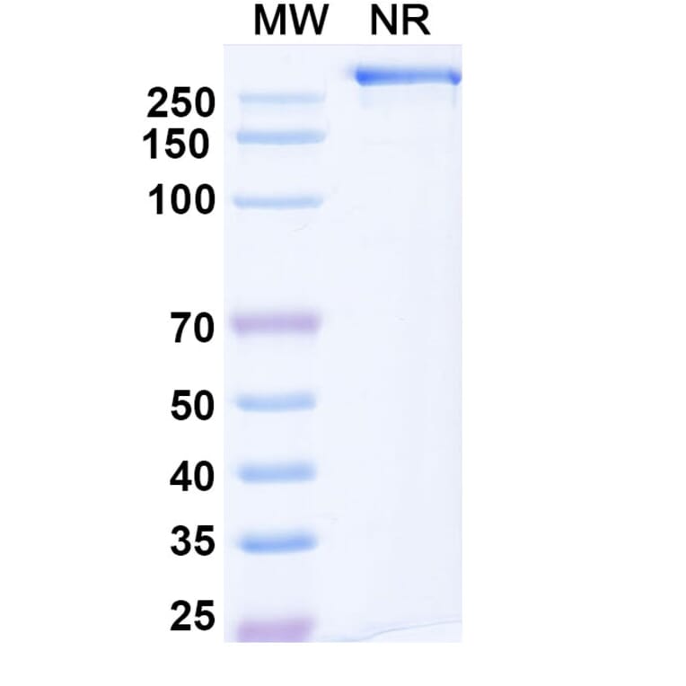 SDS-PAGE - Mozistobart Biosimilar - Anti-CD22 Antibody - BSA and Azide free (A340732) - Antibodies.com