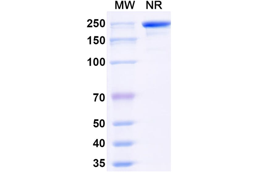 SDS-PAGE - Navenibart Biosimilar - Anti-KLKB1 Antibody - BSA and Azide free (A340733) - Antibodies.com