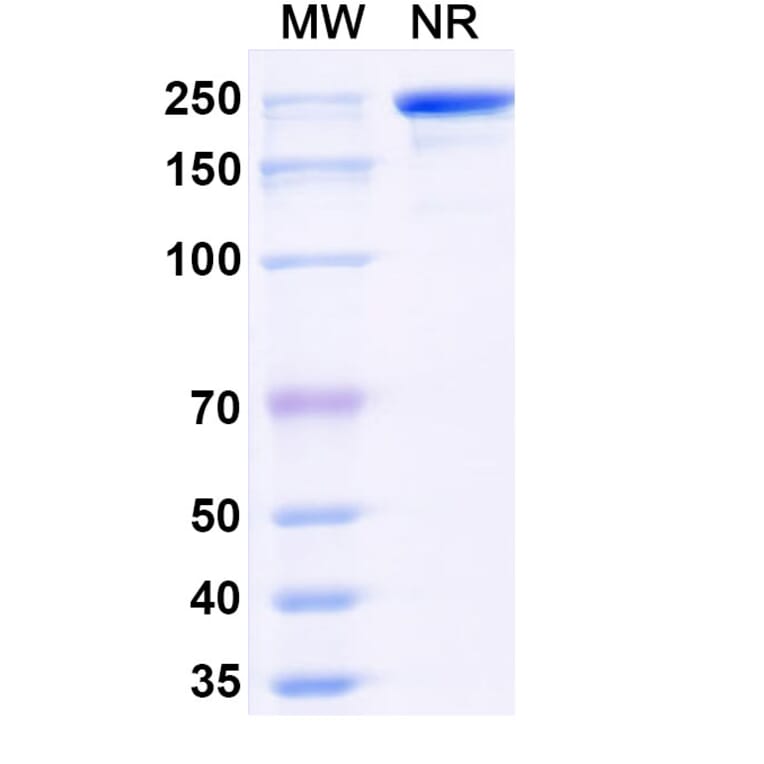 SDS-PAGE - Navenibart Biosimilar - Anti-KLKB1 Antibody - BSA and Azide free (A340733) - Antibodies.com