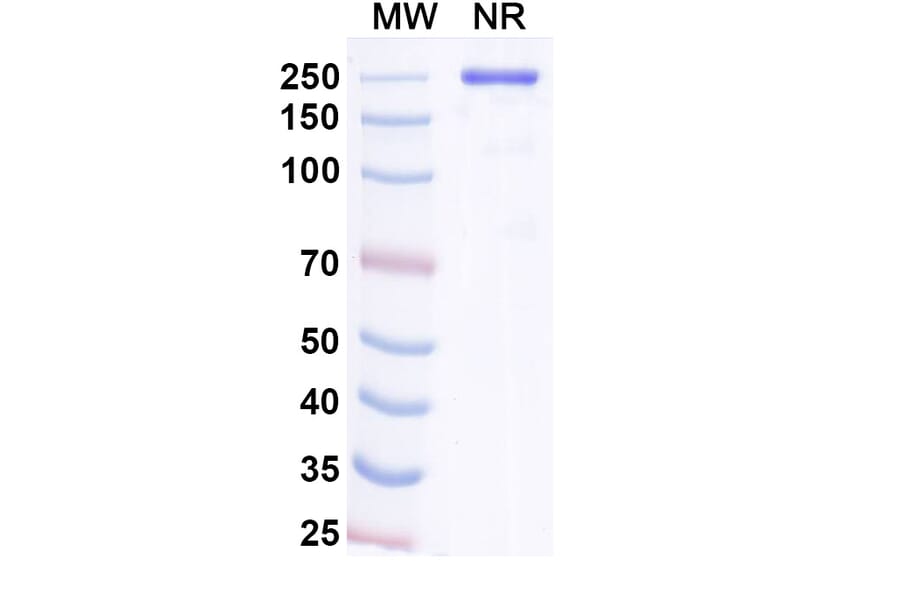 SDS-PAGE - Navenibart Biosimilar - Anti-KLKB1 Antibody - BSA and Azide free (A340733) - Antibodies.com