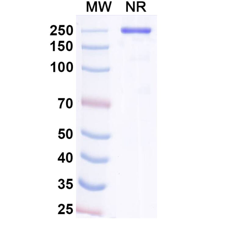 SDS-PAGE - Navenibart Biosimilar - Anti-KLKB1 Antibody - BSA and Azide free (A340733) - Antibodies.com