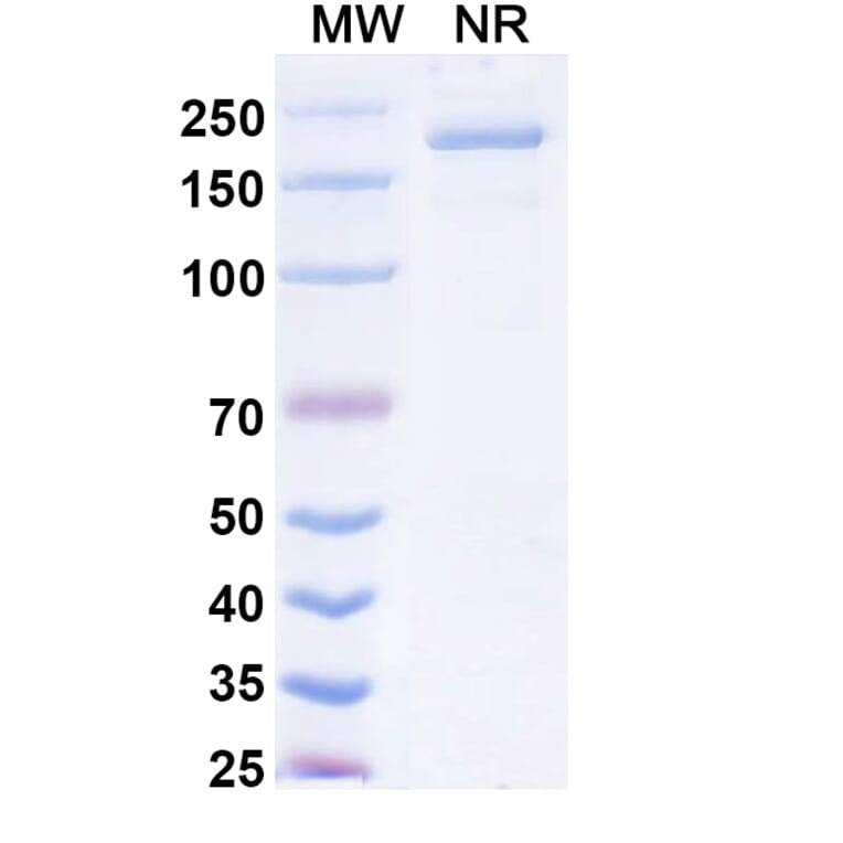 SDS-PAGE - Opugotamig Biosimilar - Anti-FOLR1 Antibody - BSA and Azide free (A340736) - Antibodies.com