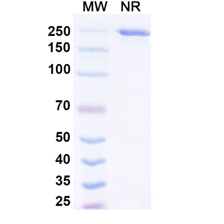 SDS-PAGE - Rinatabart Biosimilar - Anti-FOLR1 Antibody - BSA and Azide free (A340737) - Antibodies.com