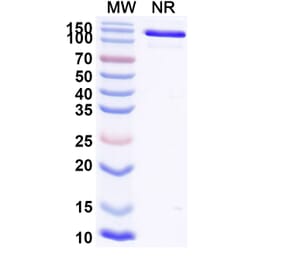 SDS-PAGE - Ozureprubart Biosimilar - Anti-IgE Antibody - BSA and Azide free (A340738) - Antibodies.com