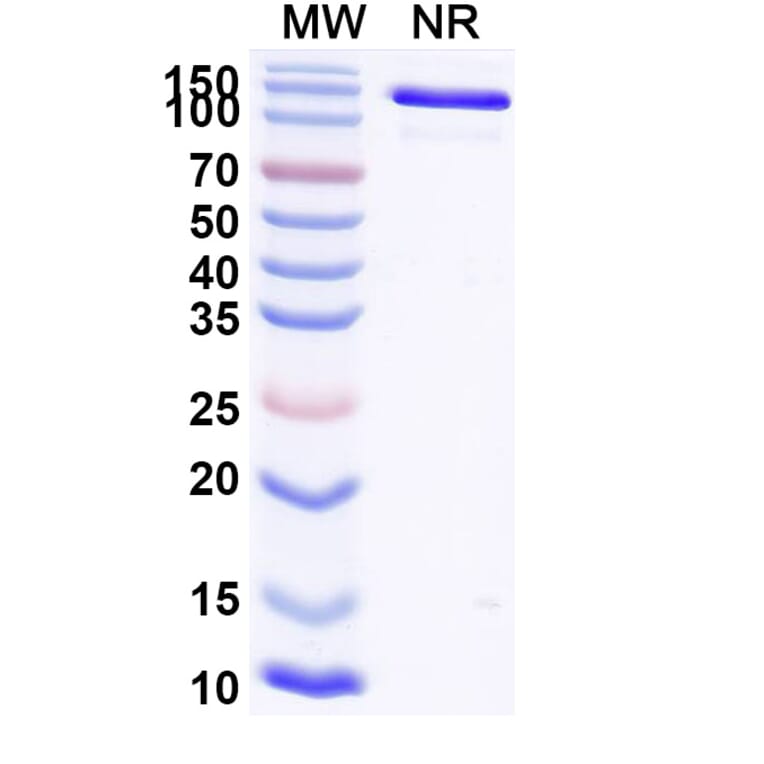 SDS-PAGE - Ozureprubart Biosimilar - Anti-IgE Antibody - BSA and Azide free (A340738) - Antibodies.com
