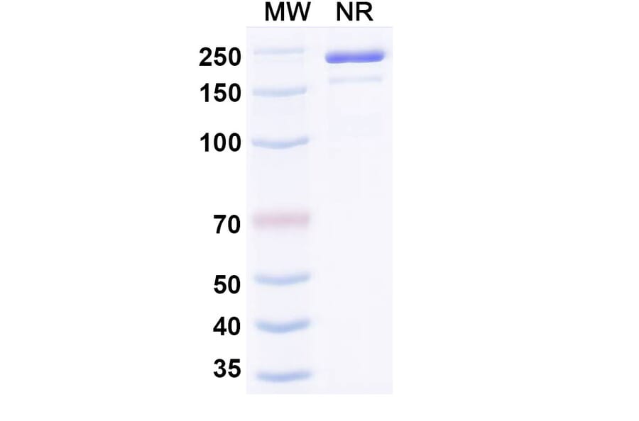SDS-PAGE - Ozureprubart Biosimilar - Anti-IgE Antibody - BSA and Azide free (A340738) - Antibodies.com
