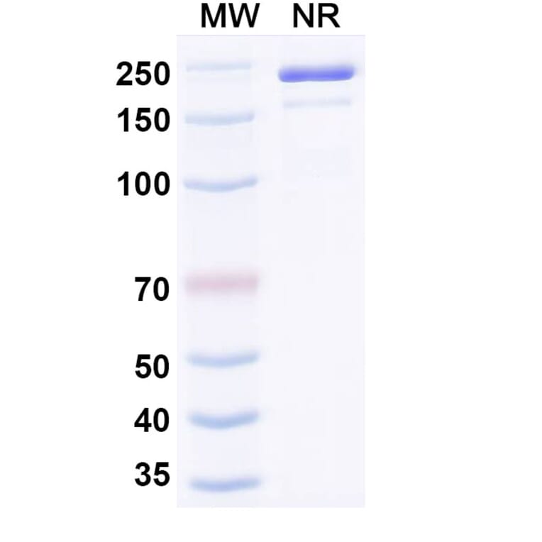 SDS-PAGE - Ozureprubart Biosimilar - Anti-IgE Antibody - BSA and Azide free (A340738) - Antibodies.com