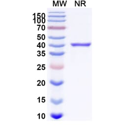 SDS-PAGE - Pegrizeprument Biosimilar - Anti-CD28 Antibody - BSA and Azide free (A340740) - Antibodies.com
