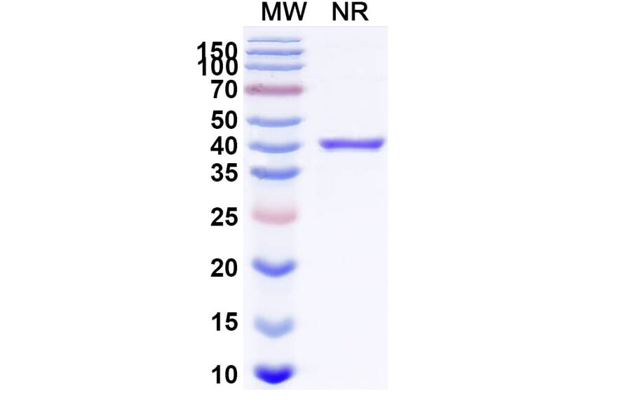 SDS-PAGE - Pegrizeprument Biosimilar - Anti-CD28 Antibody - BSA and Azide free (A340740) - Antibodies.com