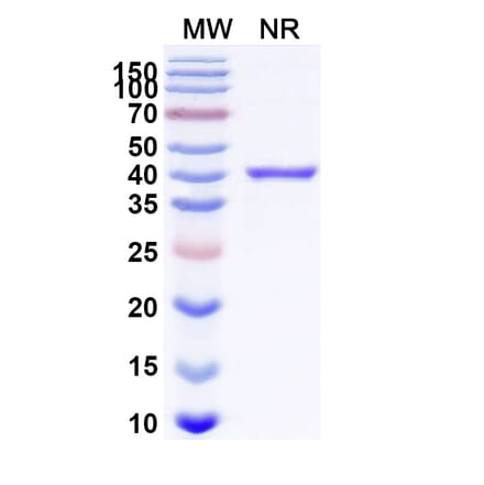 SDS-PAGE - Pegrizeprument Biosimilar - Anti-CD28 Antibody - BSA and Azide free (A340740) - Antibodies.com