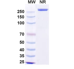 SDS-PAGE - Precemtabart Biosimilar - Anti-CEA Antibody - BSA and Azide free (A340742) - Antibodies.com