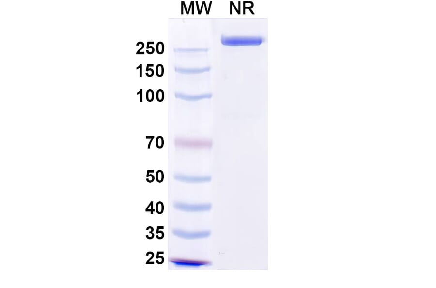 SDS-PAGE - Precemtabart Biosimilar - Anti-CEA Antibody - BSA and Azide free (A340742) - Antibodies.com