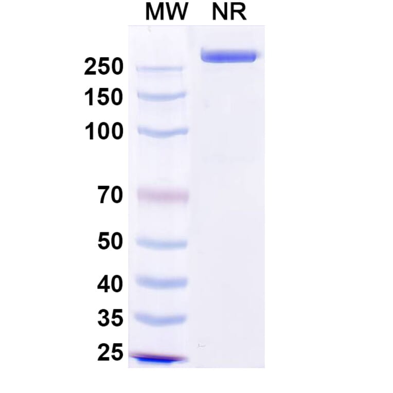 SDS-PAGE - Precemtabart Biosimilar - Anti-CEA Antibody - BSA and Azide free (A340742) - Antibodies.com