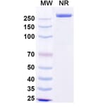 SDS-PAGE - Precemtabart Biosimilar - Anti-CEA Antibody - BSA and Azide free (A340742) - Antibodies.com