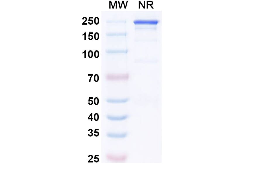 SDS-PAGE - Precemtabart Biosimilar - Anti-CEA Antibody - BSA and Azide free (A340742) - Antibodies.com