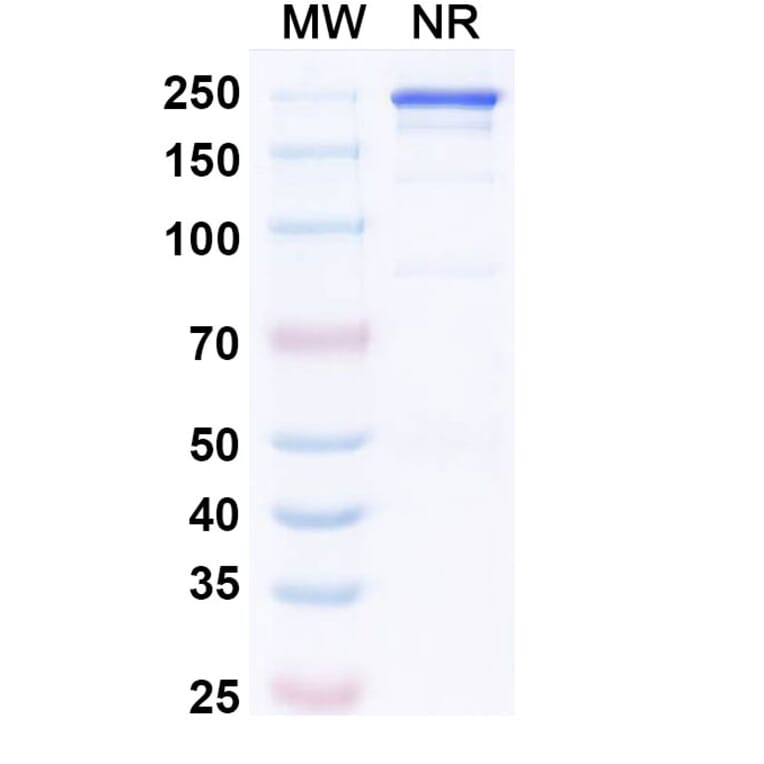 SDS-PAGE - Precemtabart Biosimilar - Anti-CEA Antibody - BSA and Azide free (A340742) - Antibodies.com
