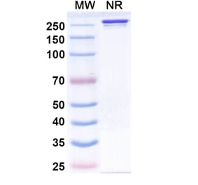 SDS-PAGE - Siltartoxatug Biosimilar - Anti-Tetanus toxin Antibody - BSA and Azide free (A340744) - Antibodies.com