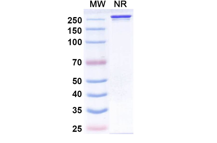 SDS-PAGE - Siltartoxatug Biosimilar - Anti-Tetanus toxin Antibody - BSA and Azide free (A340744) - Antibodies.com