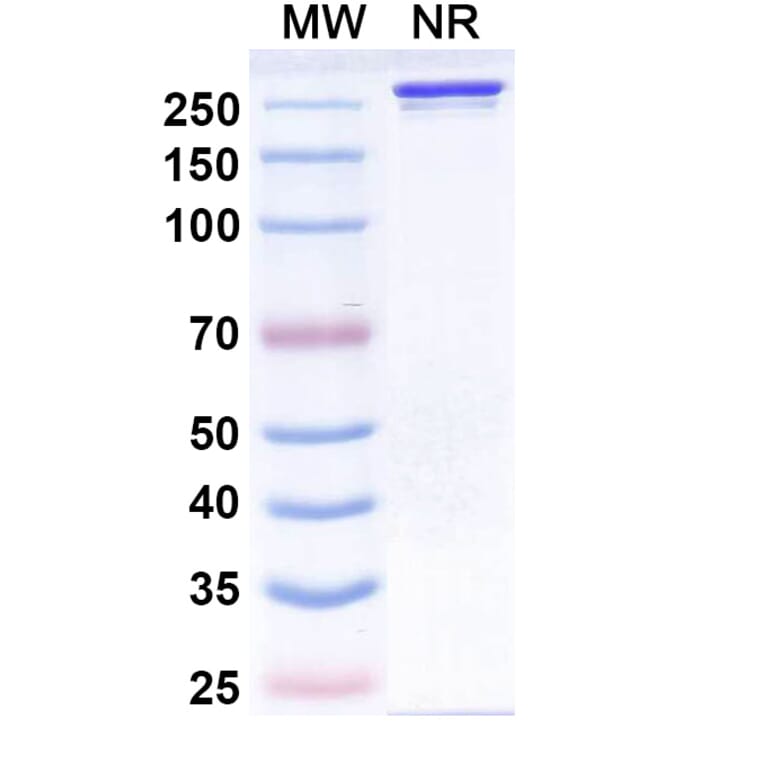 SDS-PAGE - Siltartoxatug Biosimilar - Anti-Tetanus toxin Antibody - BSA and Azide free (A340744) - Antibodies.com