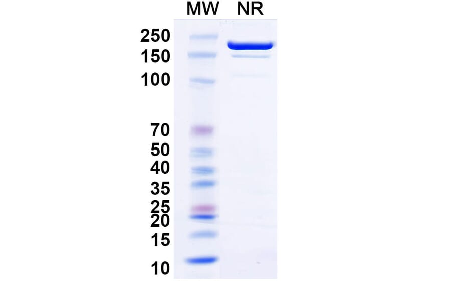 SDS-PAGE - Siltartoxatug Biosimilar - Anti-Tetanus toxin Antibody - BSA and Azide free (A340744) - Antibodies.com