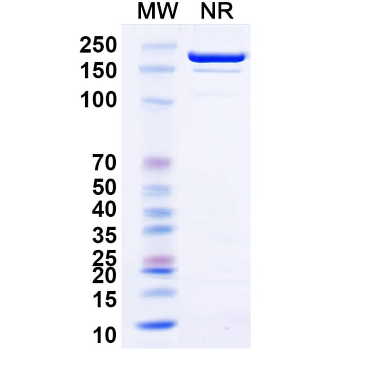 SDS-PAGE - Siltartoxatug Biosimilar - Anti-Tetanus toxin Antibody - BSA and Azide free (A340744) - Antibodies.com
